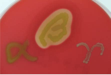 beta vs alpha hemolytic|22.4: Blood Agar Plates (BAP) .